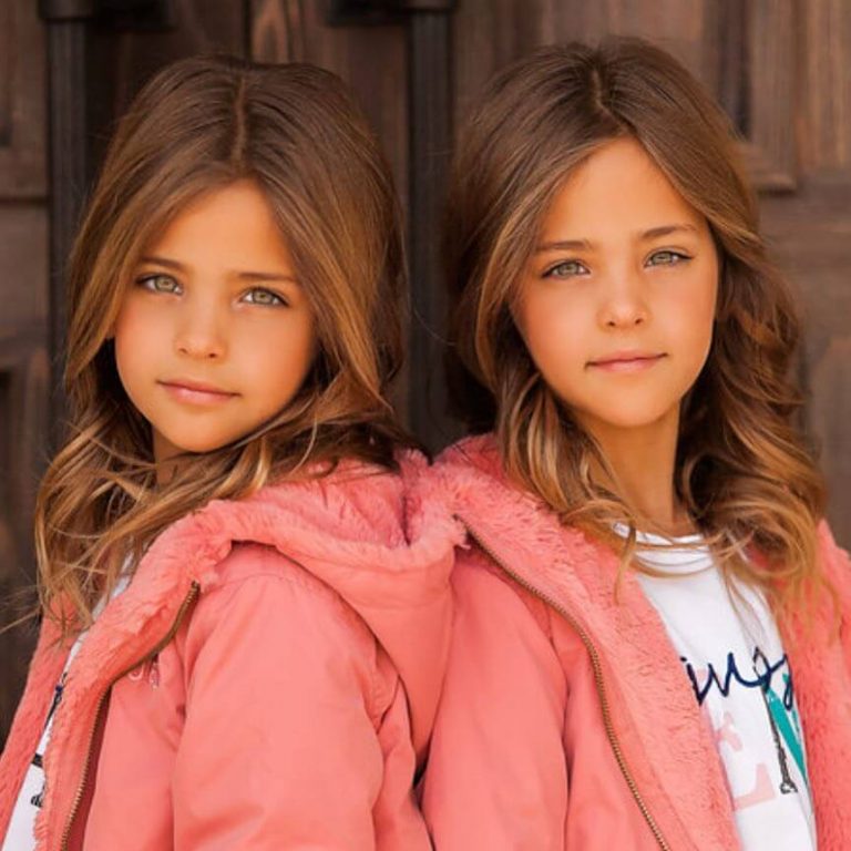 A Couple Gave Birth to the Most Beautiful Twins Ever - Page 17 of 49 - SoGo...